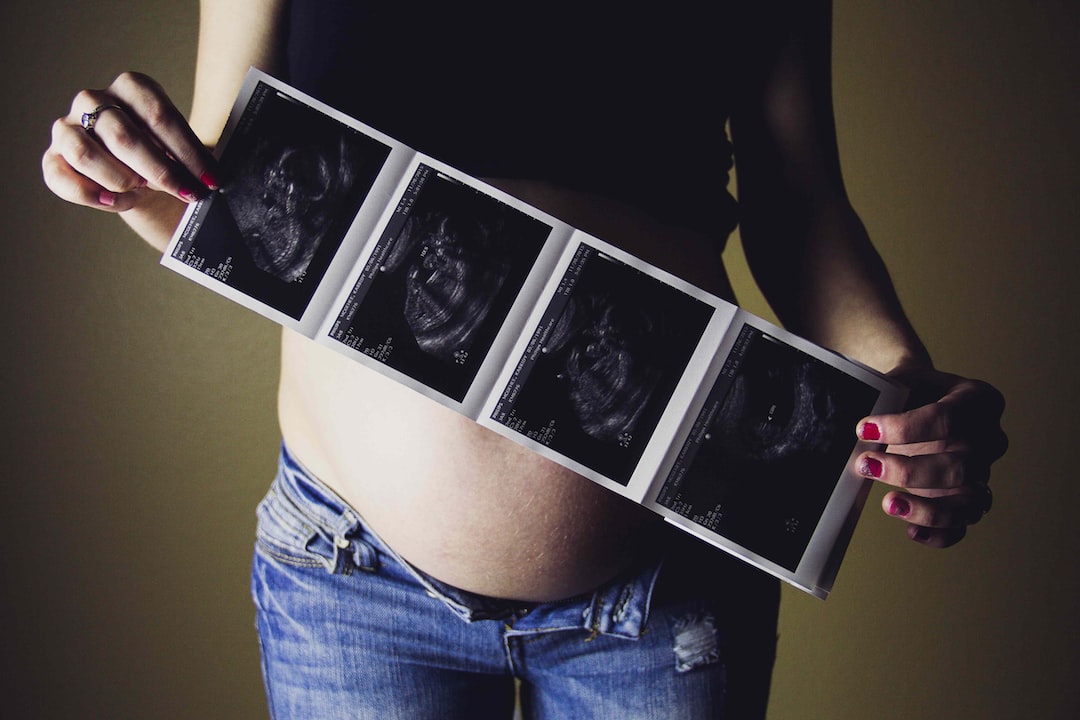 Pregnant person holding sonogram photos of pregnancy 